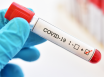 More virus cases detected in SA